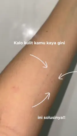 Not all body wash is made for sensitive skin. Dove Sensitive Relief = 0% sulfat, 100% comfort 💙 Kulit kalem, lembap, dan happy! #SoothingCare #GentleOnSkin #SensitiveSkinSolution 