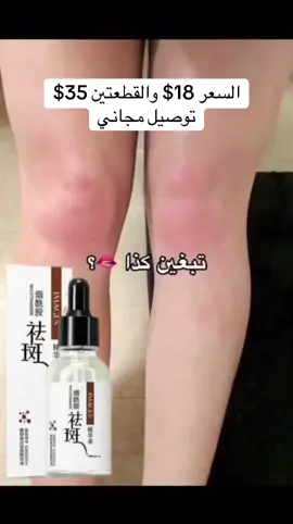 السعر 18$ والقطعتين 35$ توصيل مجاني