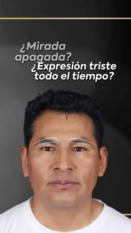 ¿Mirada cansada, expresión triste o apagada? La caída natural de las cejas con el tiempo puede cambiar por completo tu expresión… pero también puede corregirse. En Elebelle realizamos la elevación de cejas, una técnica sutil que abre la mirada, mejora el párpado superior y devuelve luz y frescura al rostro. Un ajuste pequeño con un impacto real. 📍 Agenda tu evaluación personalizada. Redefine tu belleza. #elebelle #RejuvenecimientoFacial #Tacna #peru #belleza #estetica #liftingfacia #elevaciondecejas #Rejuvenecimiento #cuidado 