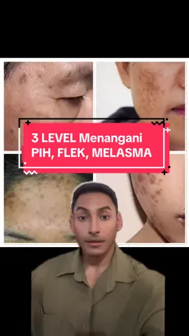 Disclaimer: as always, untuk kondisi yang parah segeralah berobat ke dokter karena mungkin kalian perlu obat keras kayak tretinoin atau hydroquinone. Tretinoin & hydroquinone bukan lebih baik hanya karena mereka lebih poten tapi studi dan bukti ilmiahnya kuat! YES skincare helps a lot tapi ada saatnya skincare doang ga cukup ya guys. Btw untuk PIH emang bisa hilang sendiri asal pake sunscreen hanya saja akan memakan waktu yg sangat lama kalo cuma berharap dr sunscreen. Kalo untuk melasma dan flek biasanya lebih kompleks jadi emang biasanya butuh tambahan skincare/obat #fyp #fypシ #skincare #viral #pih #hyperpigmentation #hiperpigmentasi #melasma #flek #flekhitam #darkspot #brighterskin #brightening #mencerahkan #mencerahkanwajah #kulitcerah #tips #recommendations #rekomendasi #EduTok #edukasi #creatorsearchinsights #education #notsponsored #educational 