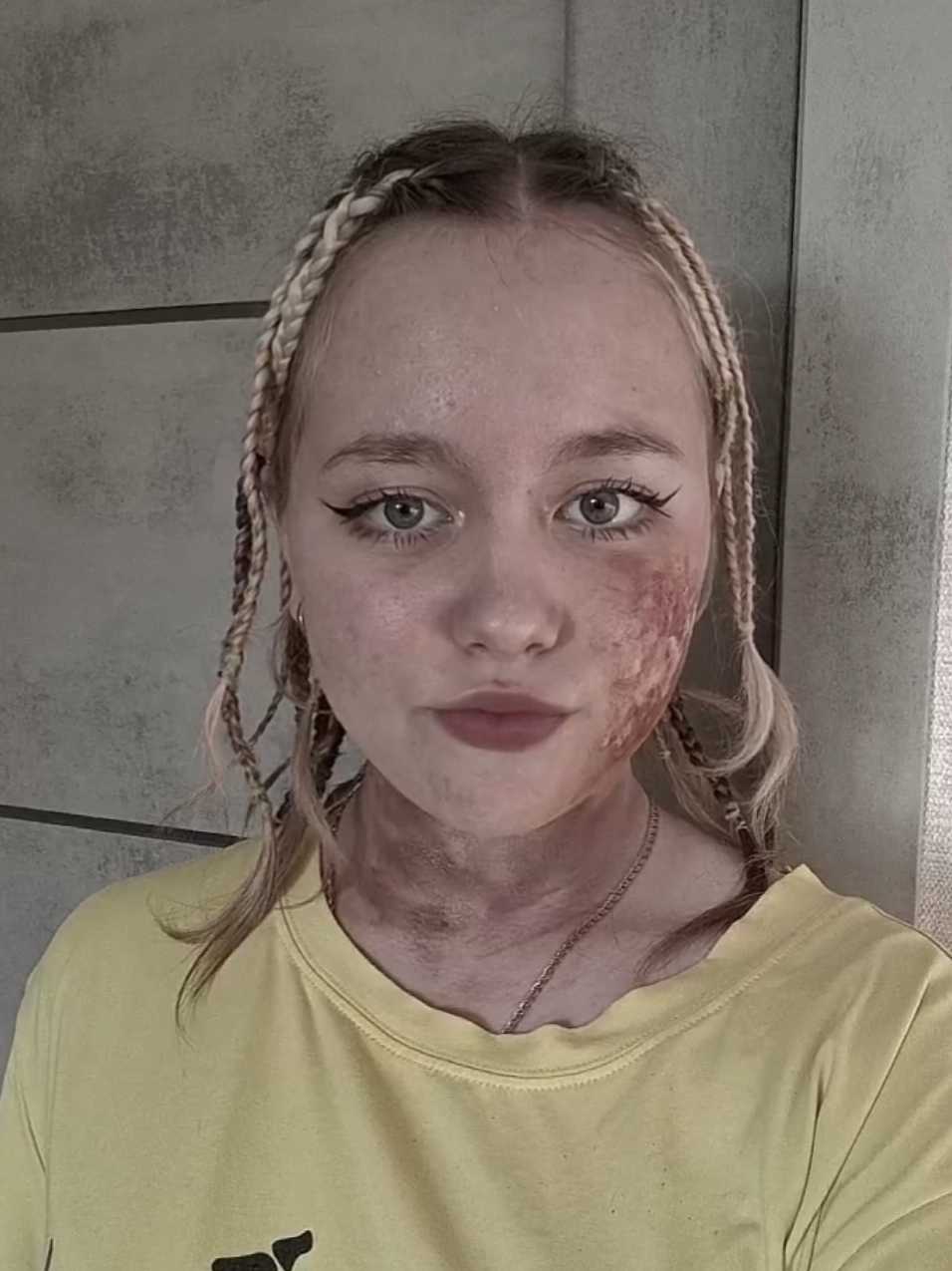....