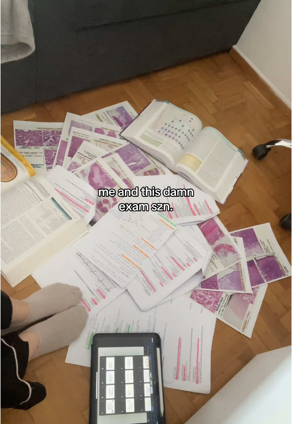 I feel like I’ve aged 5 yrs #study #studytok #studywithme #exams #examseason #medicine #medtok #medstudent 