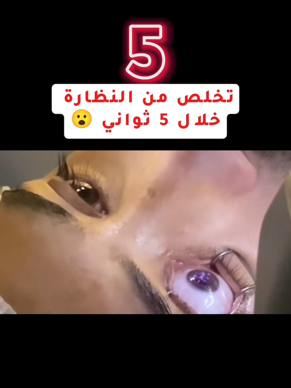 بالتقسيط لـ تصحيح النظر والماء الابيض لفترة محدودة #عروض_الصيف  في #مركز_الرائد_الاستشاري_الطبي  🇸🇦 وعلى يد نخبة من الاستشاريين السعوديين 🇸🇦 باحدث التقنيات العالمية ● العرض يشمل: هدية قيمة مجاناً جميع الفحوصات العملية 3 مراجعات مراجعات العلاجات لايفوتك العرض واحجز الان: 920031723 #تصحيح_النظر  #الليزك  #عملية_تصحيح_النظر 