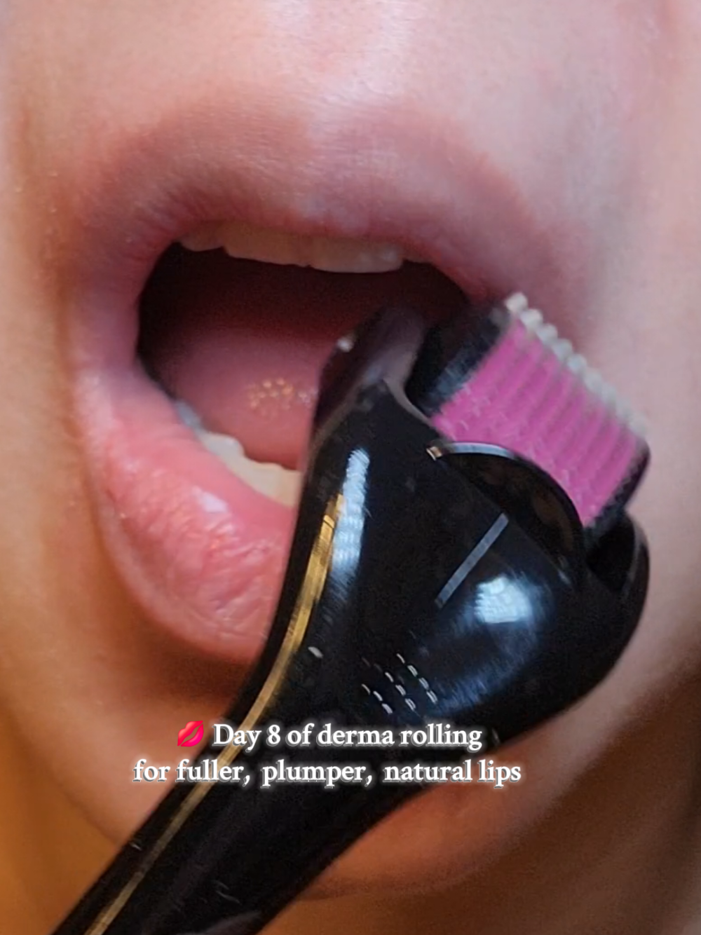 Day 8 of derma rolling  #dermaroll #fullerlips #plumperlips #foryourlipsonly #naturallips 