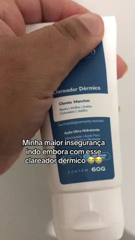 #melasma #inseguranças #manchasnapele #melasmatreatment #manchasnorosto 