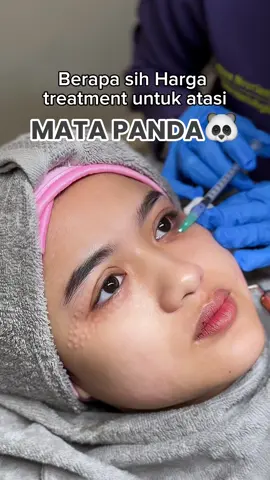 BERAPA SIH CARA NGATASIN MATA PANDA & KERUTAN HALUS DI MATA? 😩 Mata Panda bikin wajah jadi tampak lelah dan gak fresh? Dears, kurangin yuk kebiasaan begadangnnya biar gak makin parah mata pandanya hehehe, tapi Micin ada rekomendasi treatment yang bisa kamu coba, ini salah satu treatment Best Seller yang efektif mengatasi mata panda loh🫶 Kenalan lagi sama Eyebooster treatment with : SKINBOOSTER FOR EYE with NCTF 135HA ✨ 🪄Skinbooster for Eye with NCTF 135HA🪄 Merupakan treatment skinbooster yang dapat memboost pabrik kolagen (fibrolas) di kulit area sekitar mata kita untuk membentuk bantalan alami kulit seperti kolagen, elastin, bahkan hyaluronic acid alami yang dimiliki kulit. Memiliki bahan aktif utama Hyaluronic Acid dan 59 bahan aktif lainnya. Sehingga area sekitar mata akan jauh lebih lembab dan cerah, membuat tampilan lebih fresh, area mata yang gelap akan lebih cerah dan meminimalisir tampilan kerutan halus sekitar mata. Hasil akan terlihat setelah 7 hari dan bisa dilakukan pengulangan agar hasil lebih maksimal☺️ Yang masih mau tanya-tanya tentang treatment ini bisa di kolom komentar ya dears!🤗💖 #fyp #airinskinclinic 