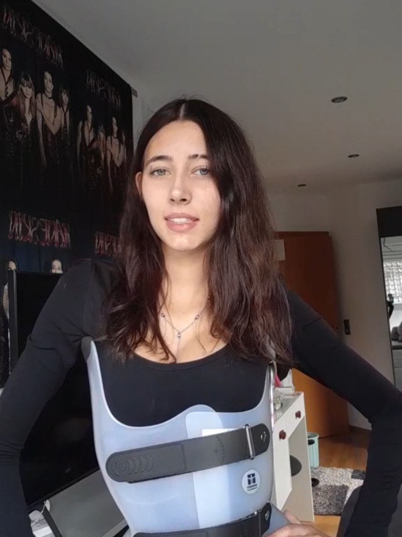 HAPPY SCOLIOSIS AWARENESS MONTH 🎉 #scoliosisawarenessmonth  #scoliosisawareness #fy #backbrace #viral #scoliosis #awareness 
