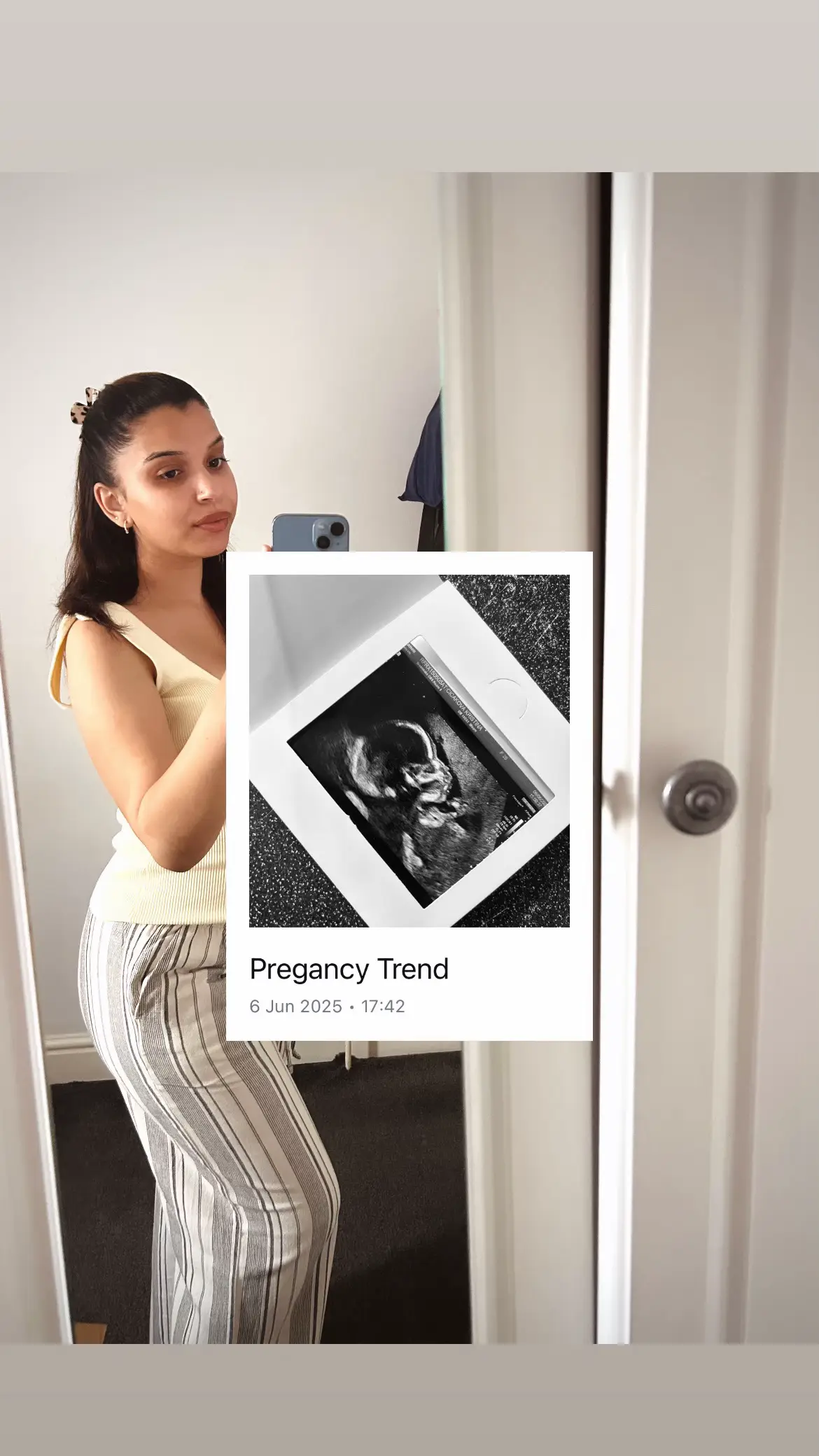 18 weeks to go🤍 #fyp #pregnancy 