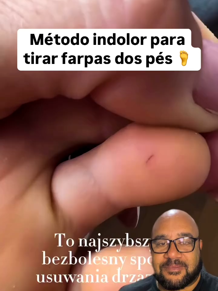Você já sofreu com farpas no pé? 🦶😩 Então anota essa dica simples e indolor pra remover farpas SEM dor e sem complicação! Chega de sofrimento — isso aqui vai mudar sua vida! 🔥 Salva, curte e compartilha com alguém que vive descalço por aí! . . . #dicautil #primeirossocorros #dicascaseiras #removerfarpa #dicasdesaude #vidadicas #dicaspraticas #truquedavida #cuidadoscomocorpo #utilidadesdomesticas #vidadodiaadia #vidacriativa #reelsbrasil #dinhodicastech #cuidadoscomopé #vidainteligente #queajudam #reelssaude #remedionatural #dicasparavida #cuidadospessoais #truquescaseiros #solucaodosproblemas #reelsutilidade #vidapratica #saudeebemestar #facavocemesmo #trucocaseiro #farpanopé #tratamentonatural #cuidadoscomapele #truqueesperto #dicaesperta #reelsvida #dicasincriveis #segredinho #dicasinteligentes #reelstop #reelsengajamento #sobrevivencia #reelsviral #removersemdores #saudavel #bemestar #dicasinstagram #cotidianointeligente #truque #aprendanotitok #educacaocaseira #autocuidados #primeirosocorroscaseiro #reelsdicas #hackdodia #dicasdevida #tutorialrapido #magnéticadicasuteis #curiosidade #vidareal