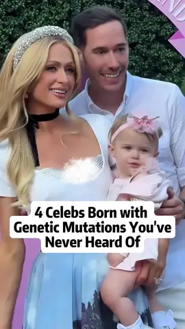 4 celebs born with genetic mutations you’ve never heard of #celebrity #hollywood #fyp #celebrities #usa #foryoupage #capcut #famous #movie #heard 