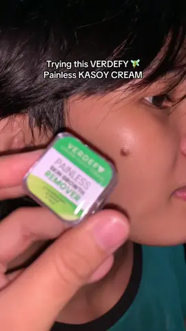 Finally! Found this verdefy kasoy cream! Follow me for more updates!! #kasoycream #kasoycreamremoval #wartsremoval #verdefykasoycream #verdefy 