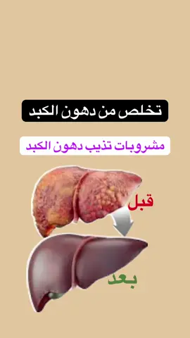 تخلص من دهون الكبد. مشروبات تذيب دهون الكبد #صحة #صحة_المرأة #صحة_عامة #صحة_تغذية #صحة_الرجل #دهون_الكبد #الدهون #الكبد #امراض_الكبد #الجهاز_الهضمي #مشروبات_صحية #مشروبات_حارقة_للدهون #معلومات #معلومات_عامة #معلومات_طبية #معلومات_مفيدة #معلومات_صحيه #نصائح_طبية #طبي #viral #fyp #foryou #explore #100k #followme #like #الهاشتاق #الهم_صلي_على_محمد_وأل_محمد #repost 