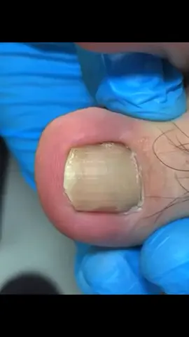 nails #asmrvideo #pageforyou #faryoupage #foryo #nailsalon #asmr #fyp #nail #satysfing #asmrtiktoks #satisfaction #nails 