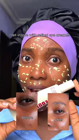 An eye cream that gets the job done @KSECRET GLOBAL retinal liposome eye cream.  Where to shop @YesStyle @STYLEKOREAN @Stylevana #GlowUpWithRetinalChallenge #ksecret #seoul1988 #retinaleyecream 