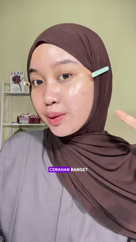 aaa kenapa baru nyobainn @msglow.beauty yaa? Ternyata baguss🫵🏻 #acneseries #msglow 