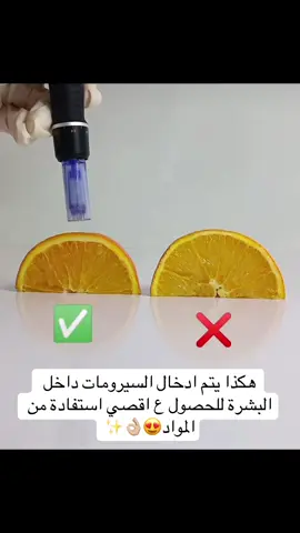 ⁨	✨ تعرفي على سر البشرة النضرة! ✨ جهاز الديرمابن يعمل بتقنية المايكرونيدلينغ (Microneedling)، حيث يُحفز البشرة على إنتاج الكولاجين الطبيعي عن طريق إحداث ثقوب دقيقة في الجلد — والنتيجة؟ ✔️ تجديد خلايا البشرة ✔️ تقليل آثار الحبوب والتصبغات ✔️ تصغير المسام ✔️ إشراقة فورية من أول جلسة! 💉 مناسب لكل أنواع البشرة وآمن تمامًا. 🎁 متوفر الآن باكدجات بأسعار خاصة لفترة محدودة! 📩 احجزي جلستك الآن أو تواصلي معنا للاستفسار عن العروض 💕 #ديرمابن #نضارة_البشرة #جلسات_عناية #عروض_تجميلية #العناية_بالبشرة #ديرمابن #نضارة_البشرة #جلسات_تجميلية #عناية_بالبشرة #بشرة_نقية #جلسات_عناية #عروض_تجميل #تجديد_البشرة #Microneedling #Dermapen #SkincareRoutine #GlowingSkin #CollagenBoost #SkinTreatment #FacialCare #BeautyClinic #SkinRejuvenation #BeforeAndAfter #SkincareGoals #GlowUp #microblading #khobar #الخبر #الدمام #dammam #توريد_شفايف⁩
