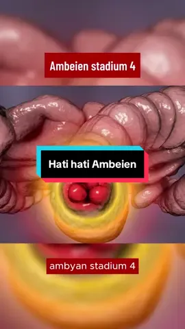 Hati hati dengan Ambeien #bendjoel #ambeien 
