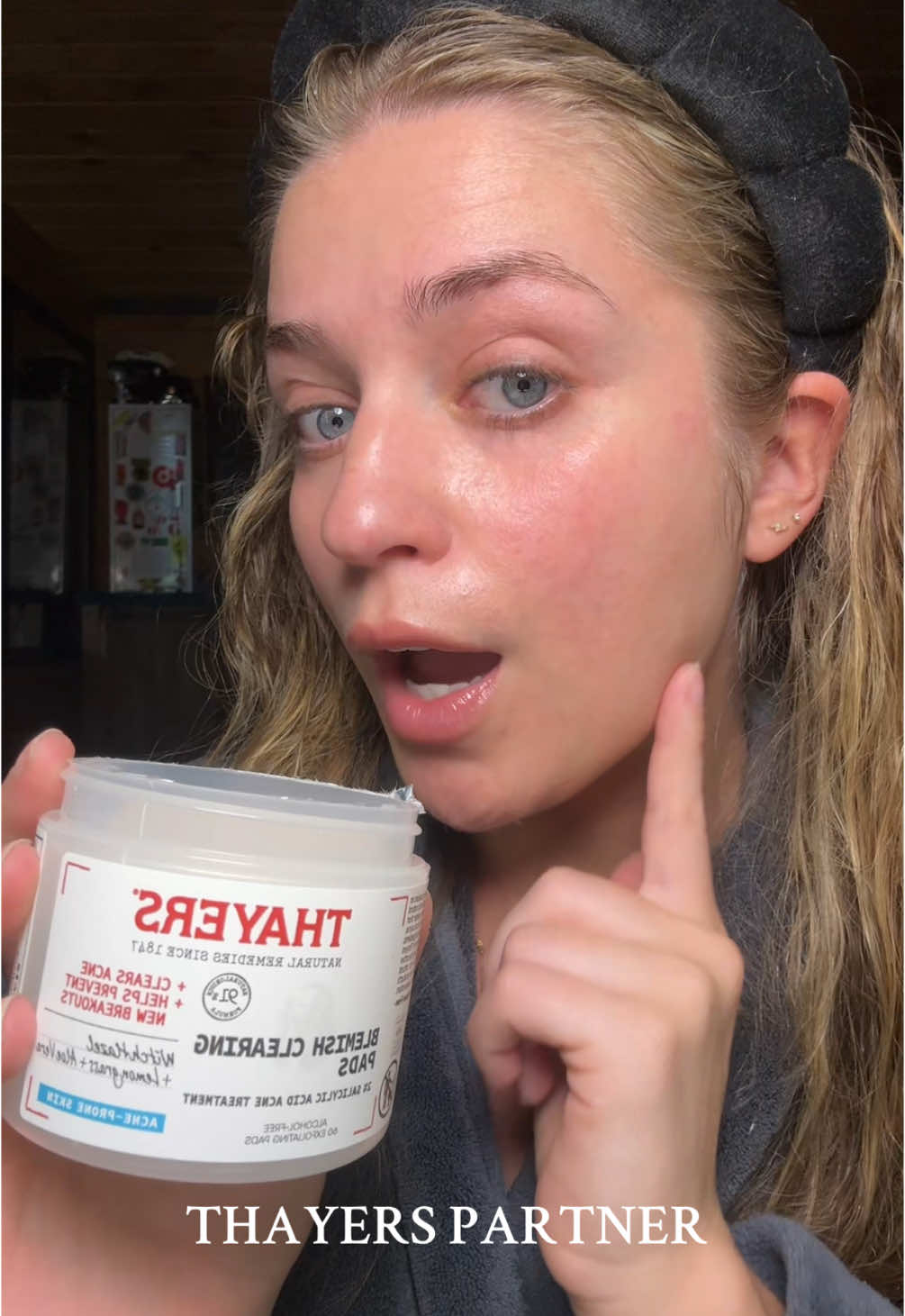 @Thayers #thayerspartner #amazon #acneproneskin #acnetreatment 