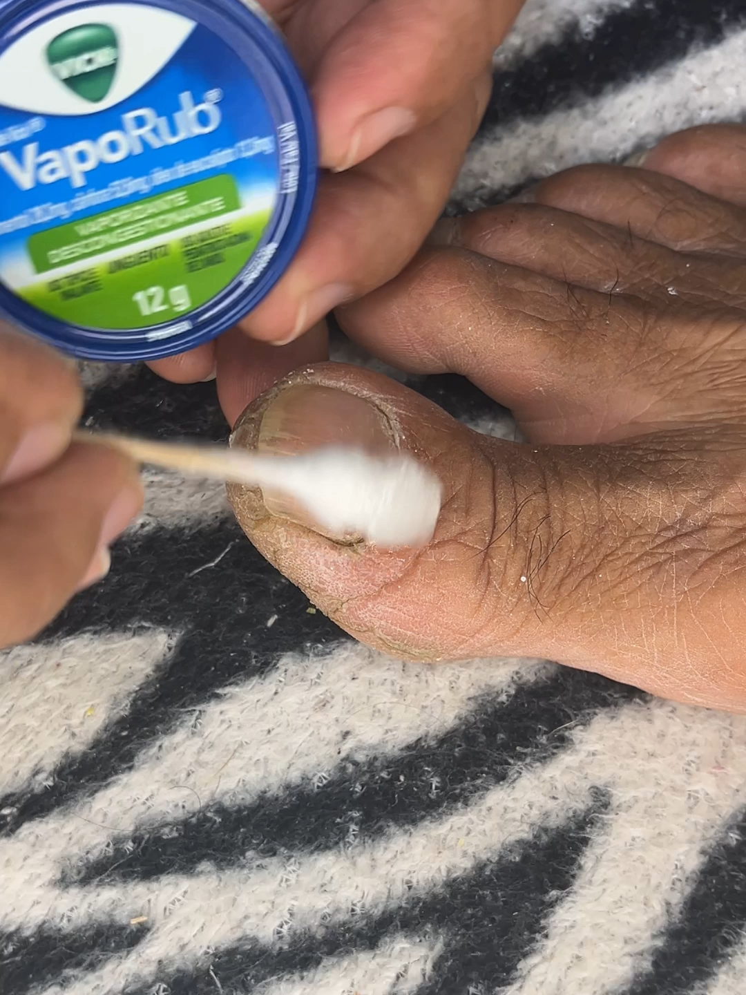 Use vick vaporub nas unhas e veja o resultado! #dicas #conselhos #saude