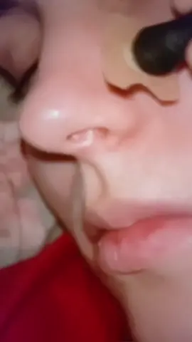 Dilatador nasal magnético anti-ronco #otorrinolaringologia #viralvideos #pravoce #dilatadornasal 