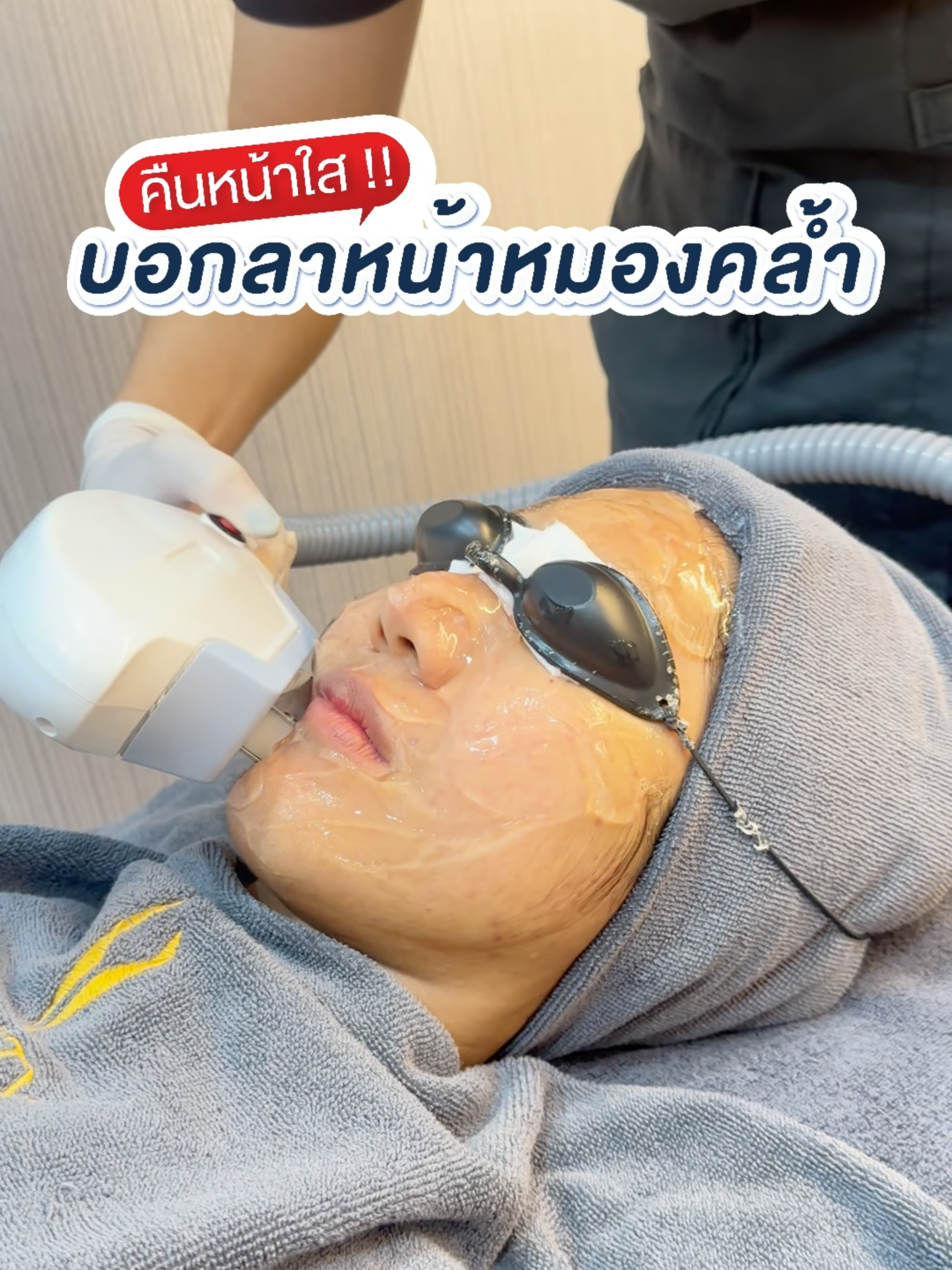 หน้าใสระดับ HD ไม่มีฟิลเตอร์ก็เอาอยู่ 💡 #เลเซอร์หน้าใส #คลินิกเสริมความงาม #เทรนวันนี้ #infinitymedicalclinic