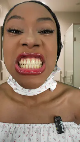 Used BodyAccel toothpaste for a week — my teeth actually got whiter! Real review✨ #Bodyaccle #toothpaste #yellowteeth #badbreath #teethwhitening #oralhealth #teethcleaning #tiktokmademebuyit #toothpaste #toothpaste #toothwhitening #gingivitis #badbreath #yellowteeth #teeth #tooth #teethwhitening #badbreath #toothdecay #foryou #TikTokShop #TikTokMadeMeBuylt|#teethcare #dealsforyoudays #teethwhitening #oralhealth #whiteningteeth #tiktokshopholidayhaul #FallDealsForYou #glamvorateethwhitening#TikTokShopSummerTurnUp #Hashtag #dealsforyouday