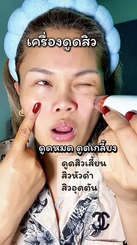 เครื่องดูดสิวเสี้ยน สิวหัวดำ สิวอุดตัน ดุููดหมด  สิวหลุดเกลี้ยง  #เครื่องดูดสิวเสี้ยน #สิวเสี้ยน #สิว #สิวอุดตัน #สิวฮอร์โมน #ดูดสิวเสี้ยน   @ช้อปตามน้ำ (ช่องหลัก) 