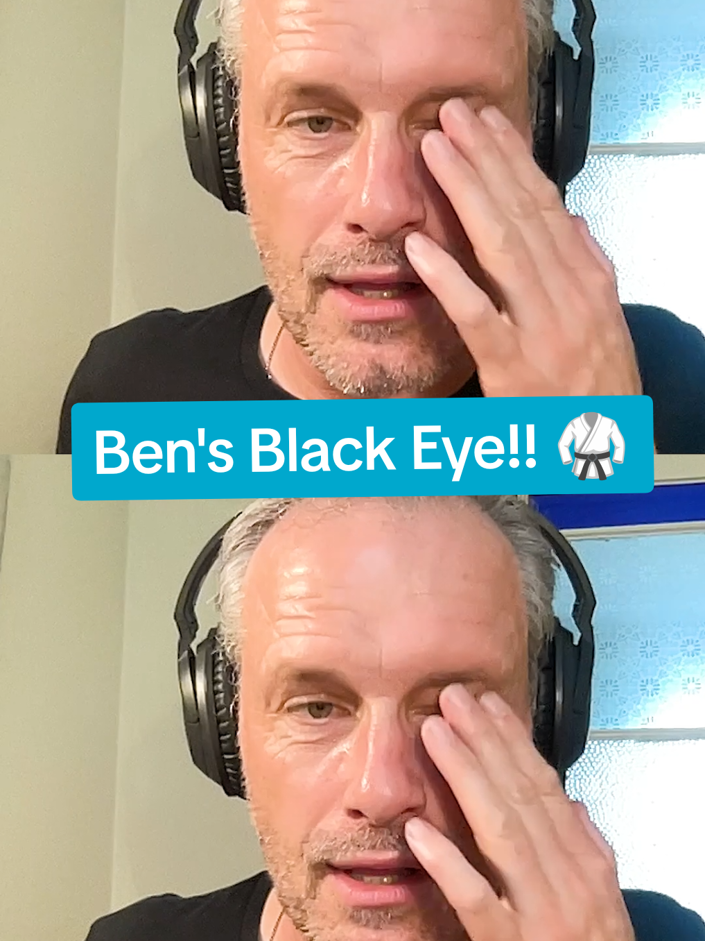 Don’t mess with Ben - he’s rocking a black eye from jiu-jitsu! 🥋👊 Today’s episode “Colson Leaves The Boys Stranded” is out now 🎙️ Hit the link in bio to listen! @Colson Smith @Jack P Shepherd  #juijitsu #corrie #coronationstreet 