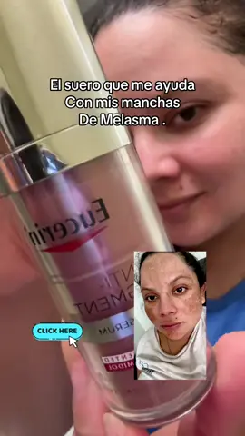 Este es el suero amigas. #melasma #EucerinAntipigment #cloasma #manchasenelrostro 