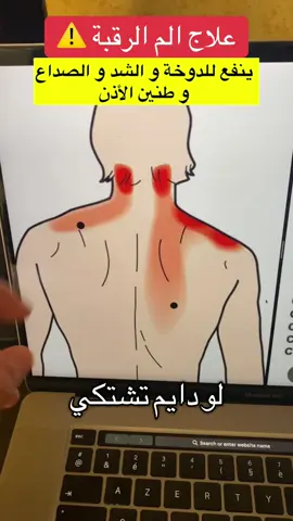 #السعودية #السعودية🇸🇦 #السعوديه #اكسبلور #اكسبلورexplore #الشعب_الصيني_ماله_حل #الشعب_الصيني_ماله_حل😂😂 #الابهر_الوثاب #الرقبة #دسك #ديسك_الرقبة #خشونة_الركبة #خشونة_المفاصل 