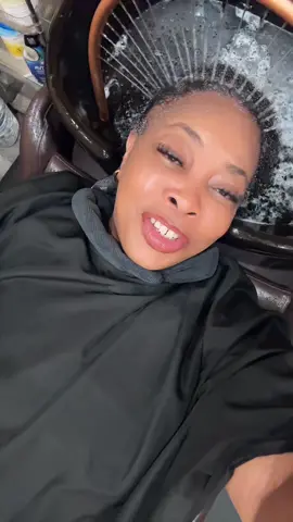 @Nadia #hairlossjourney #trusttheprocess #hairloss 