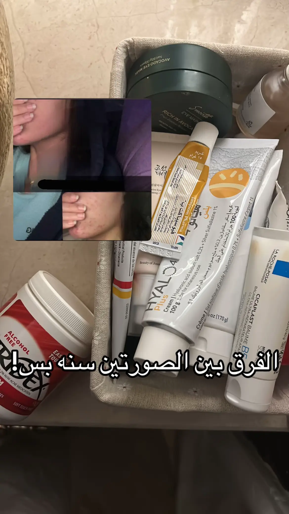 #اكسبلور #مرطبات_بشره #غسول_وجه 