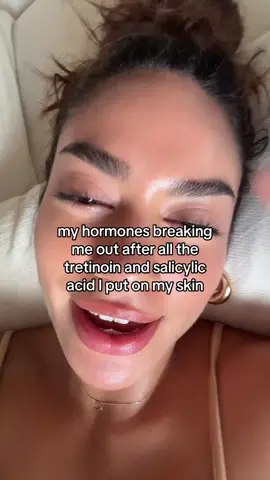 #fypシ 