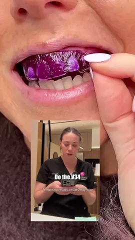 The TRUTH has been spilled 😳 #explained #exposed #dentaltok #ad
