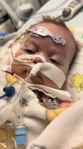 After two weeks of no movement, my boy has woken up and is saying hi to the new world.     #chdawarness #hospital #chd #heartwarrior #fourmonthsold #picu 