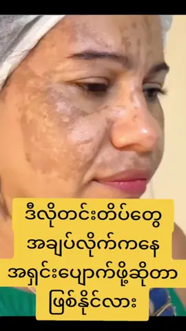 #အာမခံတင်းတိပ်ပျောက်ဆေး #avocadofacemask🥑 #မြို့နယ်ပေါင်း၃ဝ၀ကေျာ်အိမ်အရောက်ငွေချေရ #လက်လီလက်ကား #☎၀၉၆၆၆၀၂၄၇၅၀ #foryou 