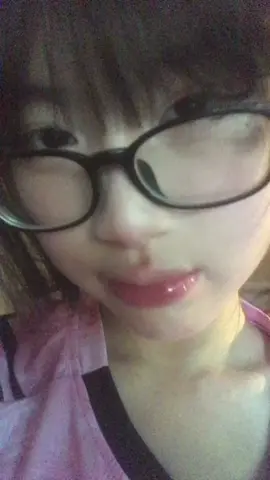 Cam thường ặ