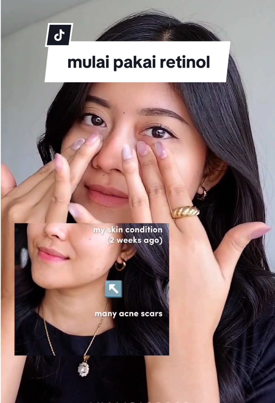 Ga hanya bantu melembabkan kulit tapi juga cegah kerutan di wajah 🩷 @glad2glow.indo #glad2glowmoisturizer #retinolmoisturizer #retinol #g2g 