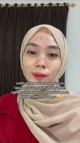 mana iya lagi🥹 #jerawat #acnefighter #acnejourney #acneskin #trend 