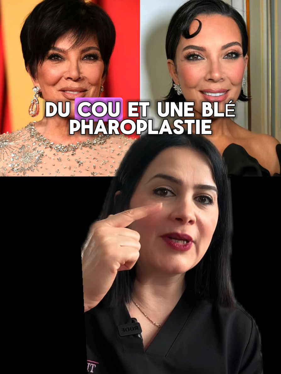On analyse Kris Jenner 👀 Vous pensez que j’ai tout vu ? Dites-moi en commentaire ce que vous pensez ? #medecineesthetique  #botox  #krisjenner  #transformationvideo 