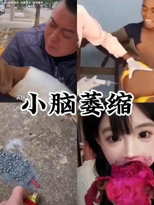 7462606293493124363小脑萎缩