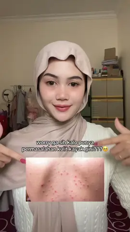 jangan dibiarin!! tapi dont worry buat kamu yang punya permasalahan kulit seperti ini, karena sekarang sudah ada produk dari @By Jevarine acne body lotion yang bisa bantu kamu nyembuhin gatal ditangan, bintik merah atau pun jerawat di punggung!! nourish your skin, adore it! 🤍🤎