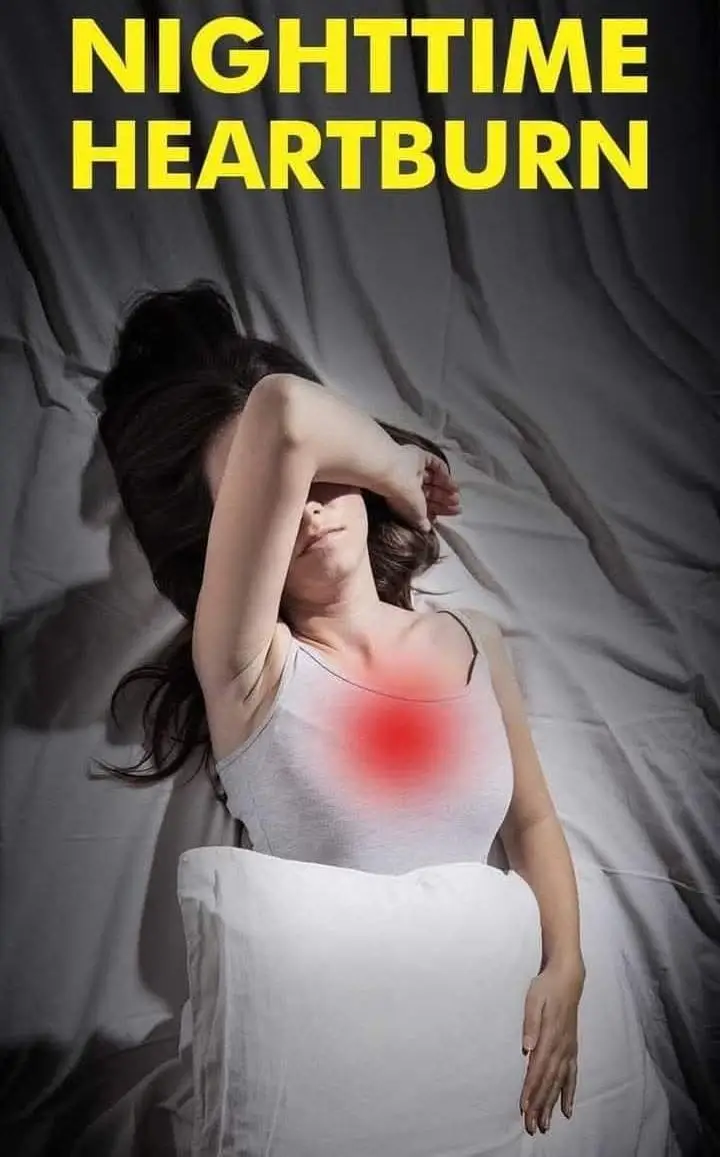 𝐇𝐄𝐀𝐑𝐓 𝐁𝐔𝐑𝐍 (𝐆𝐚𝐬𝐭𝐫𝐨𝐞𝐬𝐨𝐩𝐡𝐚𝐠𝐞𝐚𝐥 𝐑𝐞𝐟𝐥𝐮𝐱)) Heartburn is a burning, often painful, sensation in the chest (behind the breastbone) or throat. Heartburn is caused by gastroesophageal reflux (GER), when the acidic chyme in the stomach escapes back into the esophagus and even into the mouth. Normally, this reflux is prevented by the lower esophageal sphincter (a tight ring of muscle) that sits between the esophagus and stomach. The muscles of the sphincter contract to keep it closed, only relaxing to allow food boluses and liquid to pass from the esophagus into the stomach and then quickly contracting again to keep the contents of the stomach separate from the esophagus. The lower esophageal sphincter can be weakened because of increased pressure on the abdomen from obesity or pregnancy, exposure to tobacco smoke, and some medications, so the risk of GER is increased in these scenarios. Occasional heartburn is a common complaint, especially after eating large greasy or spicy meals. However, if it occurs more than twice per week, it may be diagnosed as gastroesophageal reflux disease (GERD), which should be treated not only to relieve the discomfort that it causes but also to prevent damage to the tissues of the esophagus, which can increase the risk of cancer. In addition to heartburn, GER and GERD can cause difficult and painful swallowing, a persistent sore throat or cough, a sense that there’s a lump in your throat, and nausea and vomiting.  it’s wise to see a doctor to be checked out for GERD and to discuss other treatment and medication  call 0739071232