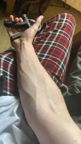 Buy hand gripper in the link for visible veins ‼️##veinyhands##vascular##armveins##hands##fyp##vein##veins##veiny##aesthetic#biceps