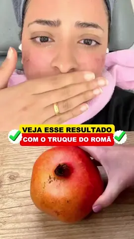 O site do tratamento está aqui na biografia! #envelhecimento #pelesaudavel #terceiraidade #dicasdebeleza #envelhecimentosaudavel #retinol #skincare #rugas