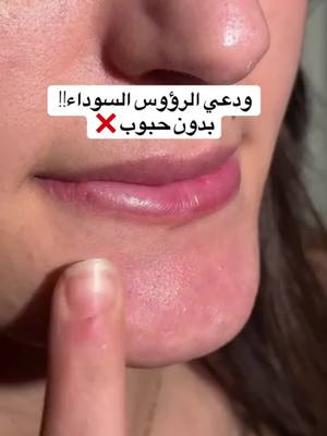 افضل حل للبشرة تاعك تنحي حب الشباب و الرؤوس السوداء  باك دارما بسعر هااايل