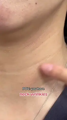 Neck care stick tighten and nourish the skin #Anti-Aging for Neck# Remove Neck Wrinkles# Neck Stick# Neck Wrinkle Fighter