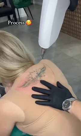 #lasertattoo #видаленнятатукиїв #lasertattooremoval #picolaser #удалениетату #удалениетатукиев #ремуверкиїв 
