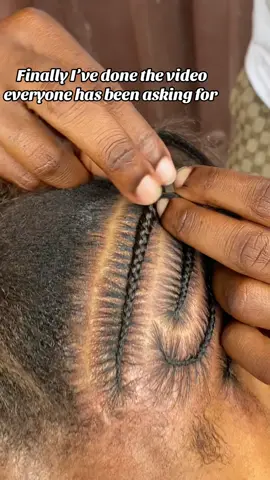 #fyp#stitchbraids #tiktoktrending #goviral #foryou #hairstyletutorial 