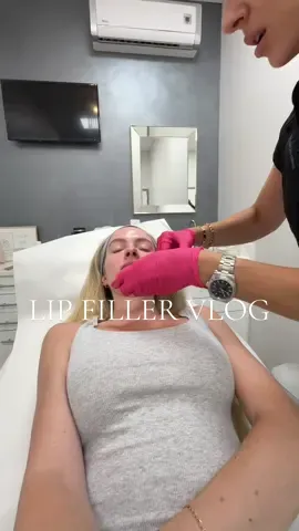 i loveeeee them👄🤭🫶🏼 thanks to the very best @jenny magliano 🤍 #lipfiller #lips #Vlog #comewithme #diml #contentcreator #beauty #Lifestyle #filler 